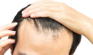 Journey of the Face – An Innovative Approach in Aesthetic Consultation